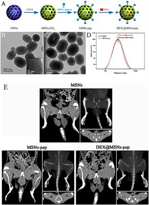 Mesoporous Silica Based Nanostructures for Bone Tissue Regeneration